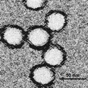 Clujean suspectat de infestare cu virusul West Nile. Doi români infestaţi au murit