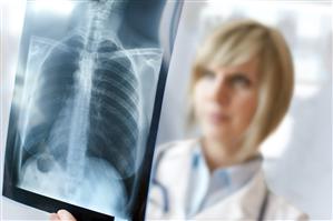 Explozia pneumoniilor. Peste 94.000 de persoane au mers la medic într-o săptămână pentru infecţii respiratorii acute