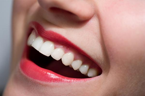 Vrei un ZÂMBET STRĂLUCITOR? Alimente pentru ALBIREA DINŢILOR