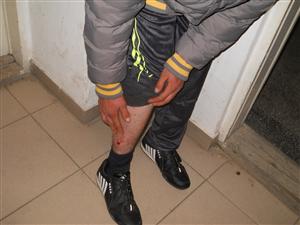 Tânăr din Sânmărghita, bătut de un intrus şi muşcat de câinii acestuia, chiar la turma tatălui