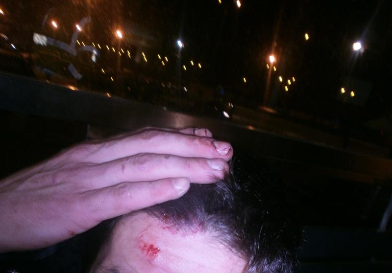Bătut crunt în alt judeţ, a fost adus la Cluj, unde a murit de... ulcer