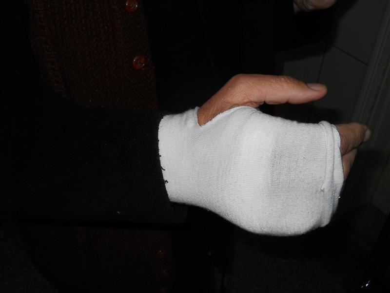 Ziua de Cluj | Taximetrist bătut de un client beat. S-a ales cu contuzii şi  un deget fracturat