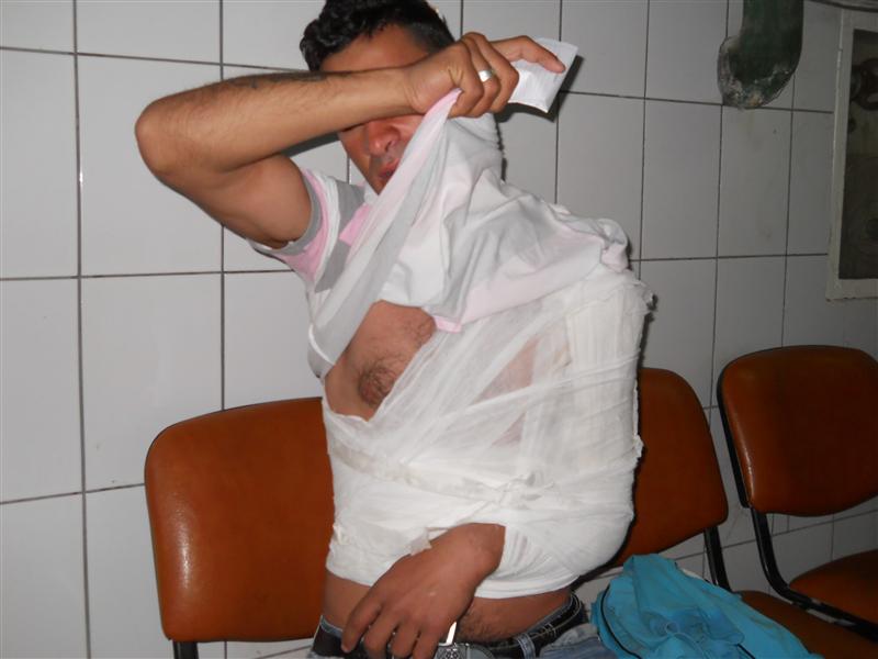 Tânăr rupt în bătaie de un grup de romi. S-a ales cu clavicula ruptă şi capul cusut în trei locuri
