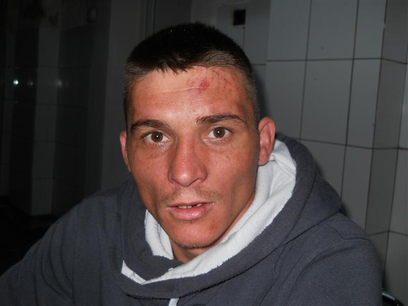 Tânăr lovit cu o sticlă în cap. L-a deranjat pe un client al barului, concentrat la partida de „păcănele”