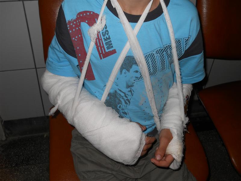 Sport extrem. Un elev de clasa a III-a s-a ales cu ambele mâini fracturate la ora de sport