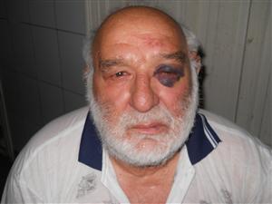 Bărbat de 72 de ani din Cluj-Napoca, bătut crunt de către un vecin, chiar în propria-i casă