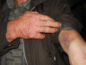 Un bărbat de 66 de ani, lovit cu furca în cap şi în piept de către doi săteni