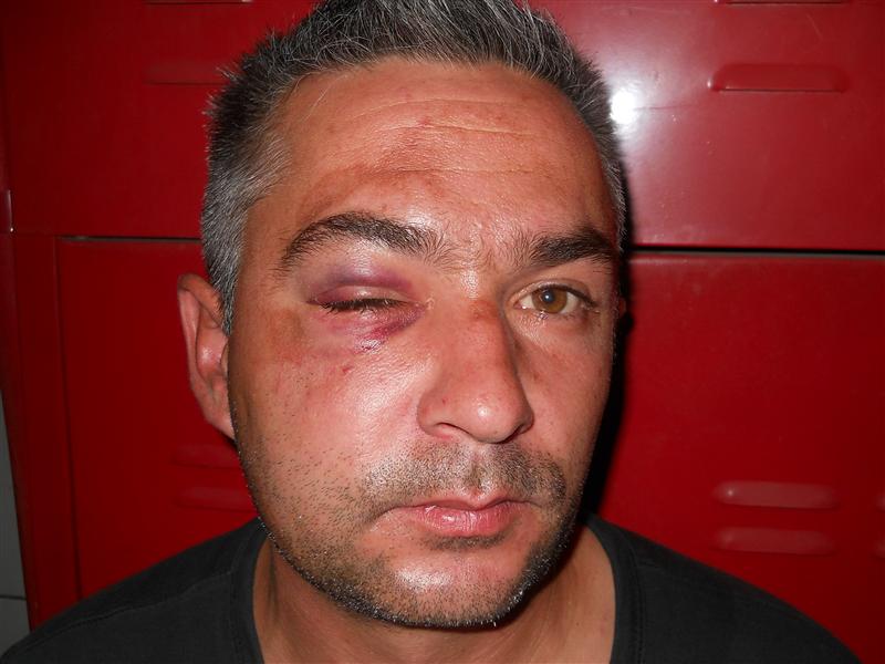 Un pietrar în vârstă de 35 de ani, “distrus” pentru a doua oară de bătăuşul Arnold  