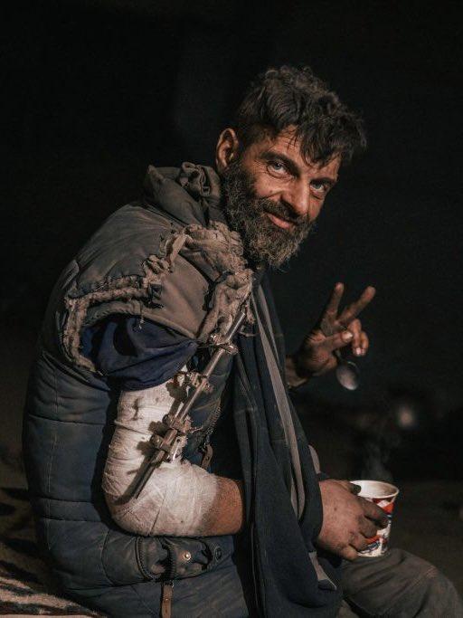 Eroul cu mâna ruptă de la Azovstal a fost operat în SUA. Cum arată acum