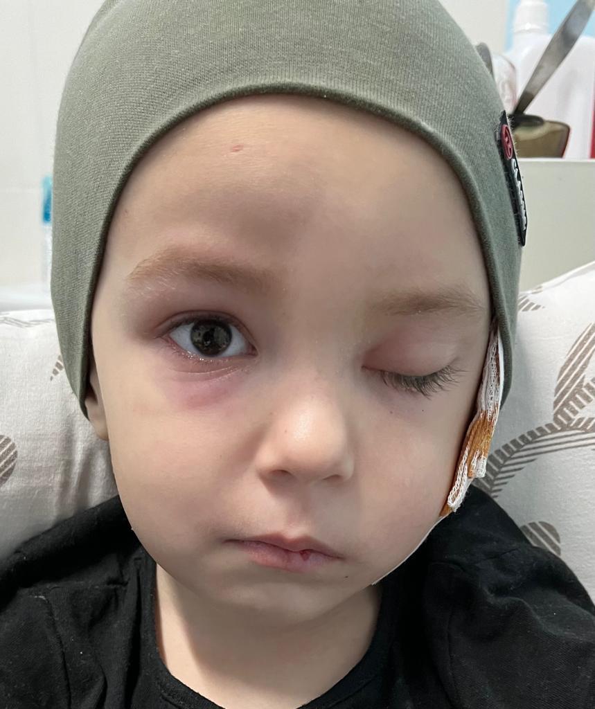 Salvează o inimă! 115.000 €, prețul pus pe viața unui băiețel de 4 ani care înfruntă cancerul cu inocență și durere