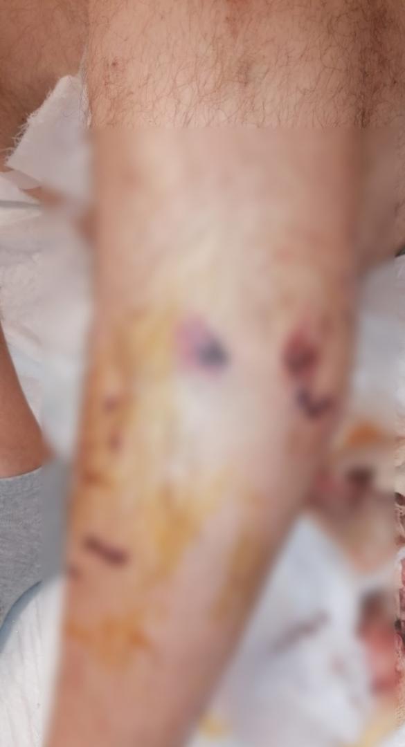 Scene de groază în Florești! Un bărbat a fost atacat de o haită de câini. "Mi-am protejat fetița de șase ani. Am reușit să o ridic pe umeri"
