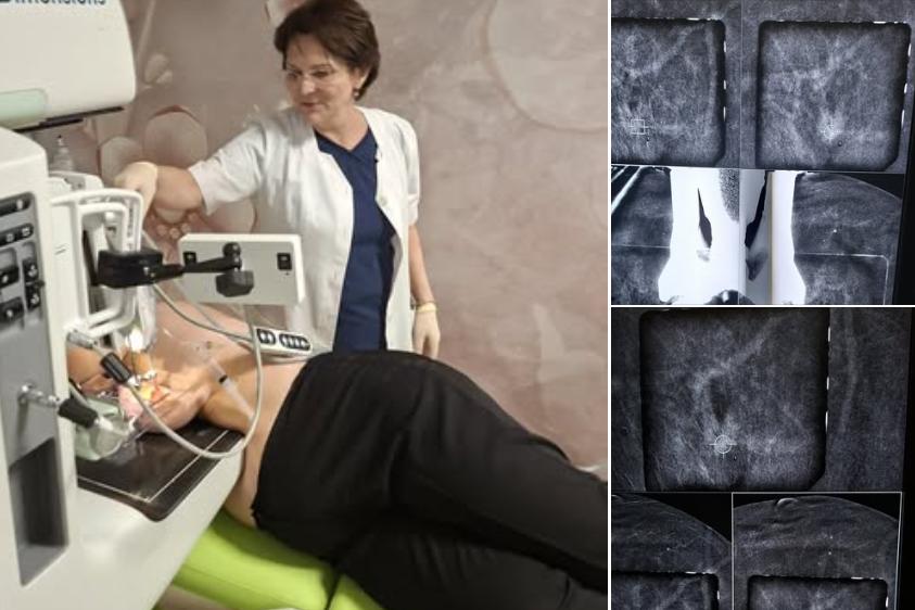 O nouă armă &icirc;mpotriva cancerului, activată la Cluj! Procedură esențială, mai accesibilă dec&acirc;t RMN-ul, disponibilă acum la IOCN