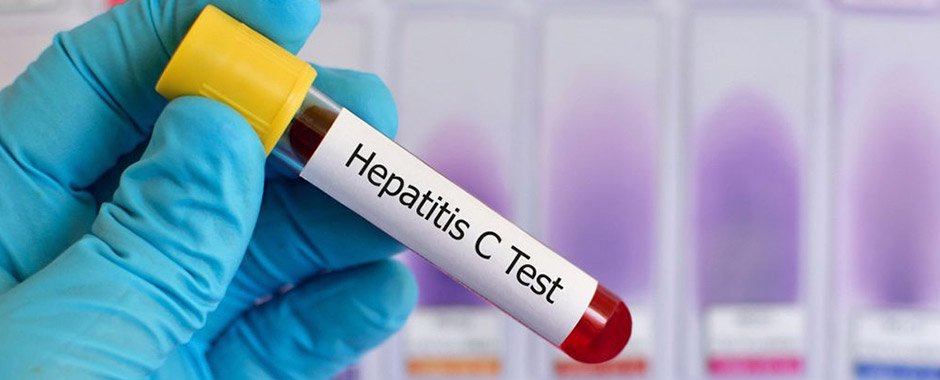 Oamenii săraci din Turda, testați pentru hepatita B și C