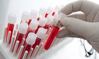 Un test de sânge ar putea ajuta la alegerea celui mai potrivit tratament pentru cancerul de sân
