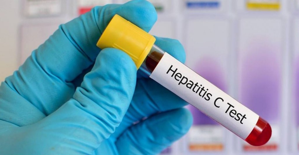 Teste rapide pentru depistarea hepatitei C la Cluj