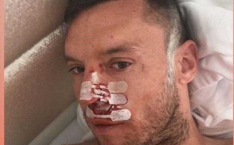 Accidentări în lanț la CFR Cluj. După ce Bud și-a spart nasul, Omrani a suferit o comoție în meciul cu Astra