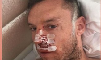 Accidentări în lanț la CFR Cluj. După ce Bud și-a spart nasul, Omrani a suferit o comoție în meciul cu Astra