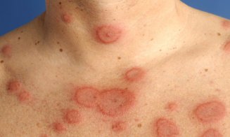Boală extrem de contagioasă, depistată în Ucraina, la graniţa cu România