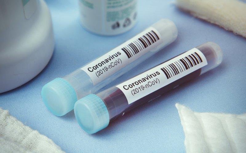 Clujul a primit 100 de kituri de determinare rapidă a coronavirusului
