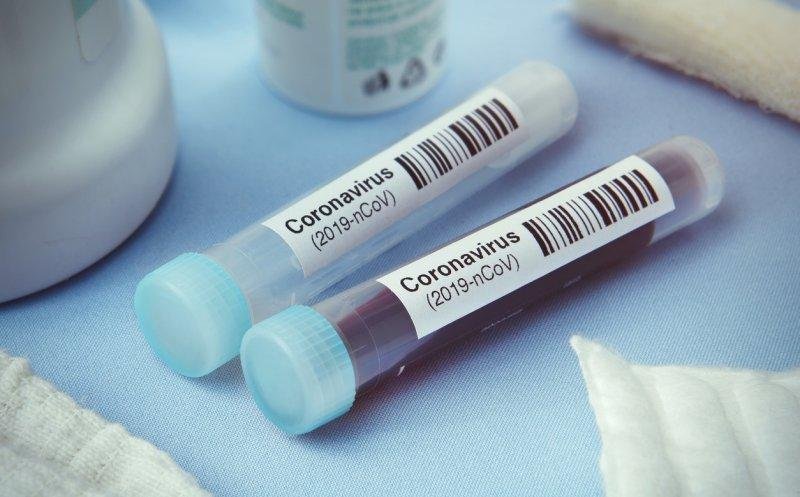 CORONAVIRUS/ Dosar penal pentru o persoană din Olt pentru că părăsit domiciliul, deși era în izolare
