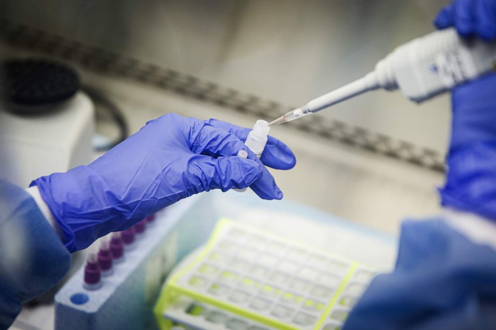 Test pentru noul coronavirus care dă rezultatul în 15 minute