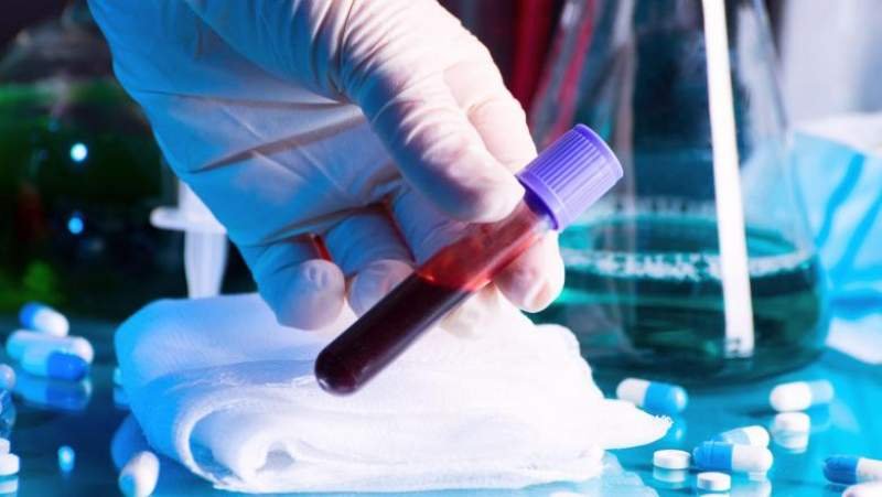 Coronavirus / Orban: Scopul nostru e să creștem la peste 15.000 de teste zilnice