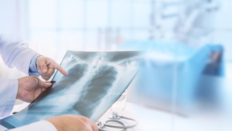 Pacienta de 39 de ani, care a murit de COVID-19 fără să aibă alte boli, nu mai avea suprafață pulmonară cu care să respire