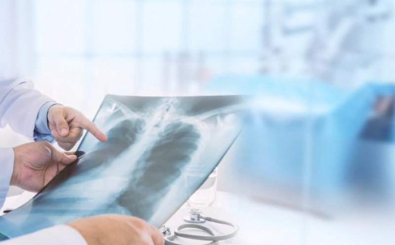 Pacienta de 39 de ani, care a murit de COVID-19 fără să aibă alte boli, nu mai avea suprafață pulmonară cu care să respire