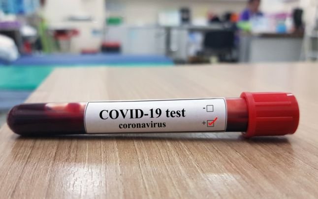 Testat pozitiv cu SARS-CoV2, tuşeşte, are febră, dar medicii îi spun să stea acasă. Nu mai sunt locuri în spitale?