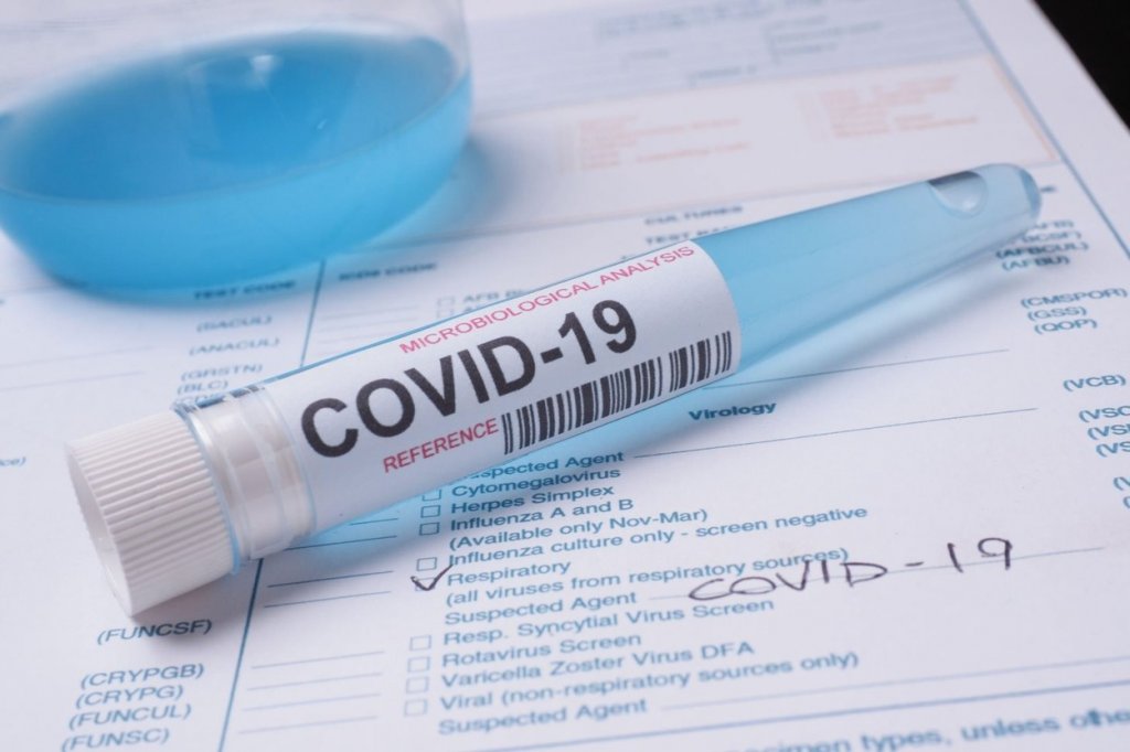 Un director de spital din Cluj-Napoca le cere autorităților schimbarea metodologiei de testare COVID-19