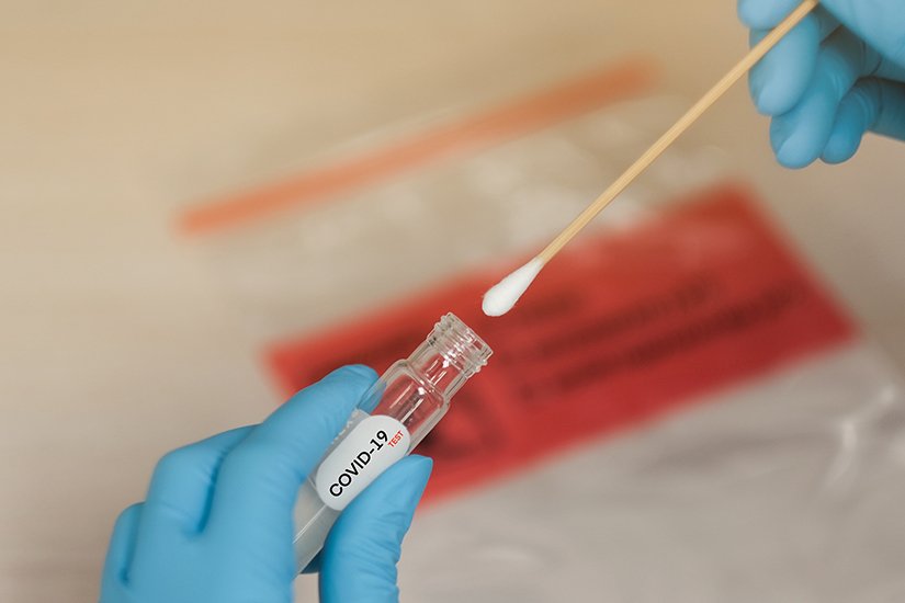 Kit-urile pentru testele de diagnosticare COVID-19 sunt pe terminate la DSP-uri?