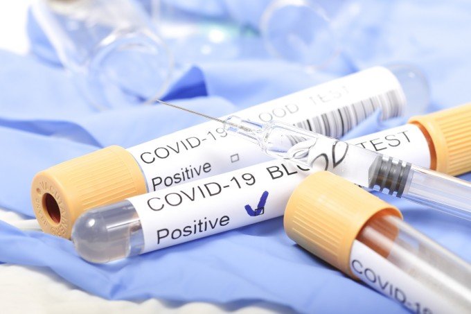 România a depășit 60.000 de infectări cu coronavirus. 1350 de cazuri noi şi 43 de decese în ultimele 24 de ore
