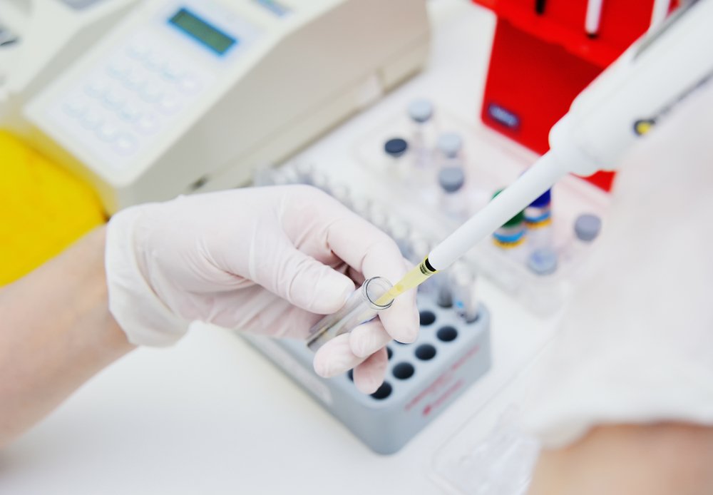 Testarea pentru Covid 19 în laboratoarele private acreditate ar putea fi oprită. Statul nu a acoperit costul testelor PCR