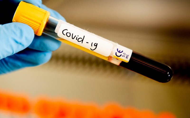 Industria testelor COVID-19. Câţi bani au încasat într-o lună pe teste clinicile private şi de stat