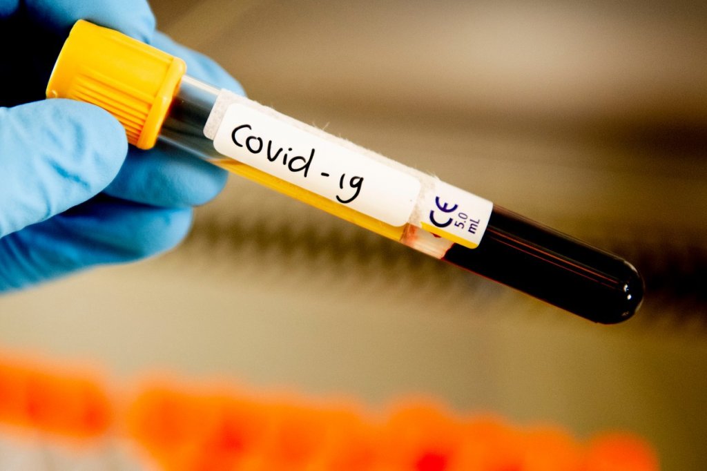 1.365 de cazuri noi de COVID-19 în ultimele 24 de ore şi 32 de decese
