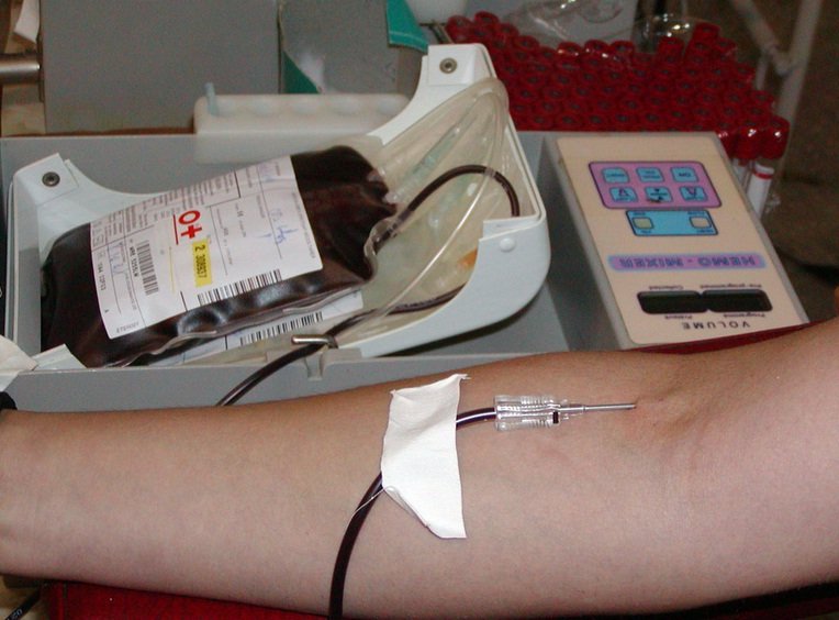 COVID-19 închide un Centru de Transfuzii. 12 din 18 cadre medicale sunt infectate