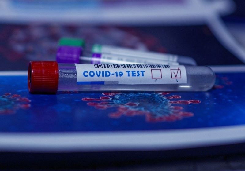 Testare în loc de carantină pentru călătorii din Europa?
