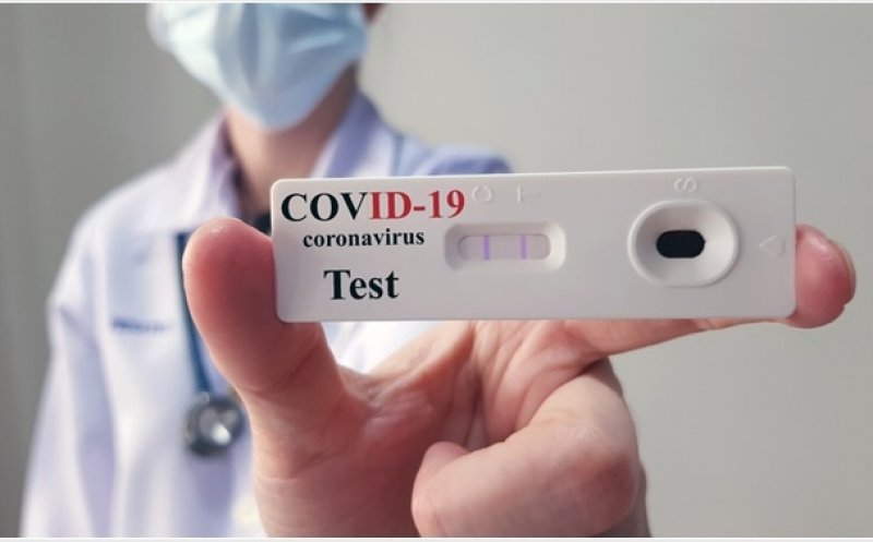 Capacitatea de testare în România ar putea creşte dacă ar fi reglementate şi testele de anticorpi