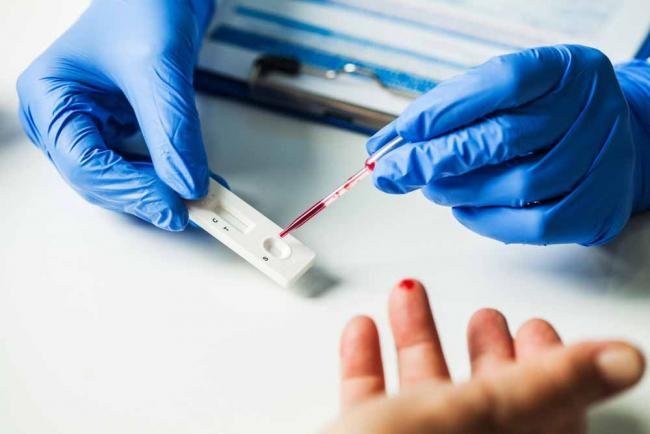 O  ţară din Europa începe testarea în masă a populaţiei pe 4 decembrie
