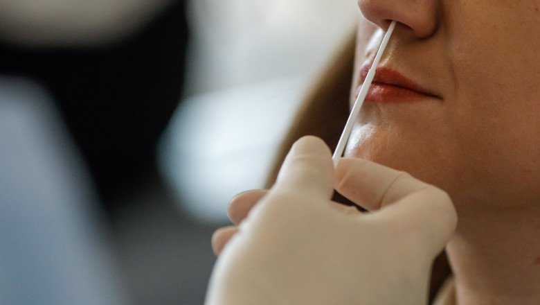 5.158 de cazuri noi în ultimele 24 de ore, la un nivel de testare redus. Un deces la categoria de vârstă 0-9 ani