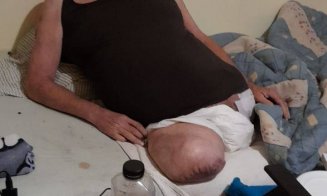 Clujean cu picioarele amputate cere ajutorul oamenilor: „Nu stiu cât mai am de trăit și vreau dacă se poate să-mi trăiesc ultimele zile în normalitate
