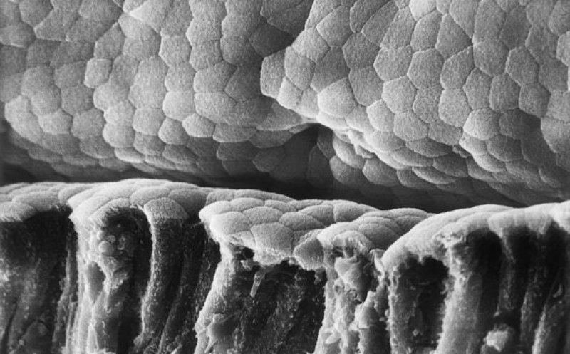 Bacteriile intestinale influenţează severitatea bolii COVID-19 . Ce spun studiile