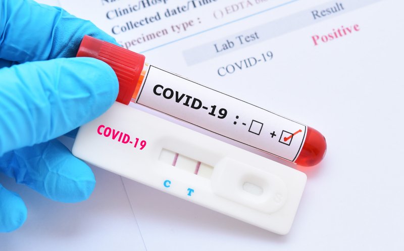 Testele rapide pentru COVID ar putea fi găsite și în farmacii