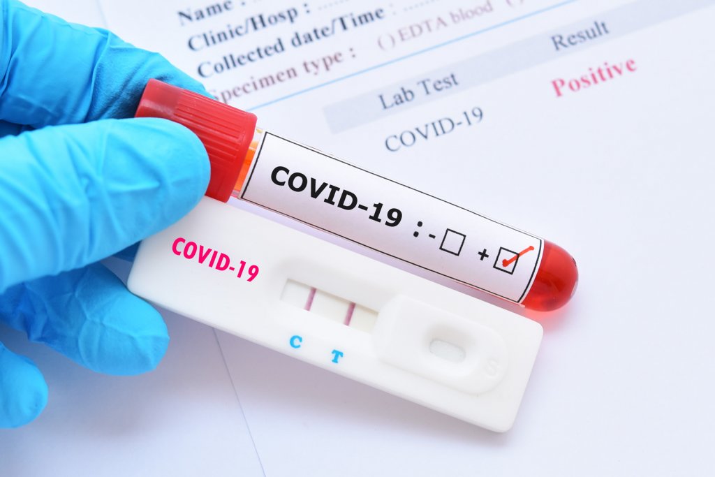 E oficial! Farmaciile pot face teste pentru depistarea COVID-19