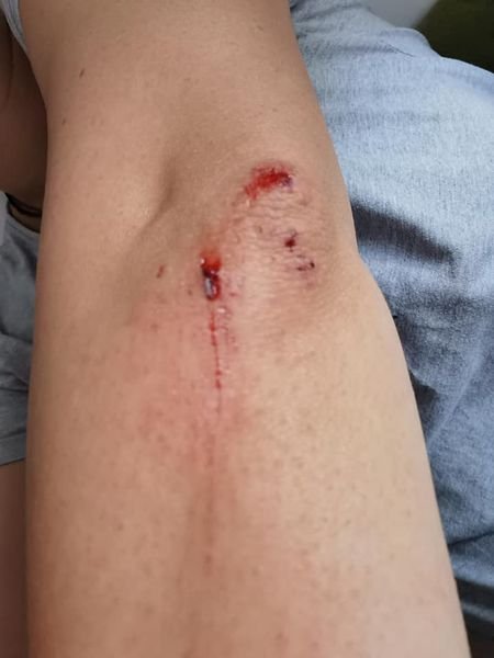 Mamă și copil pe bicicletă, loviți de un livrator: "Era cu ochii în telefon"