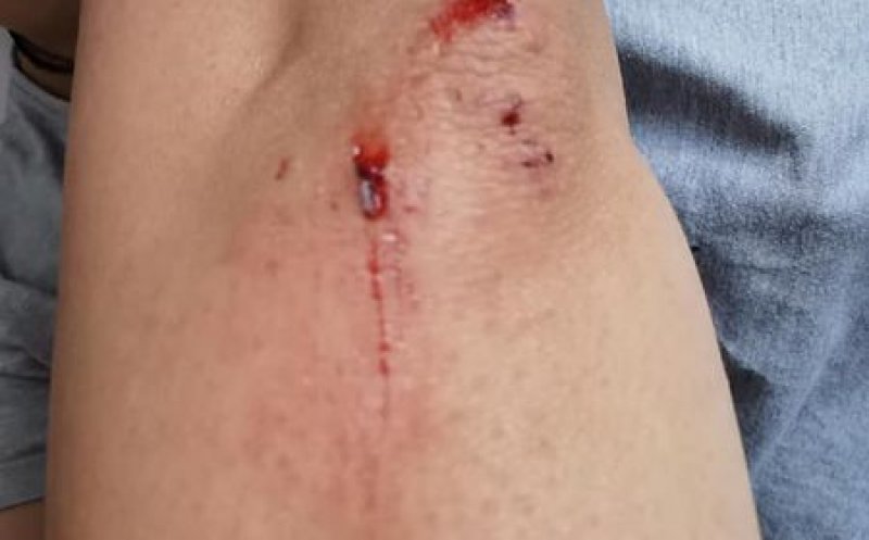 Mamă și copil pe bicicletă, loviți de un livrator: "Era cu ochii în telefon"