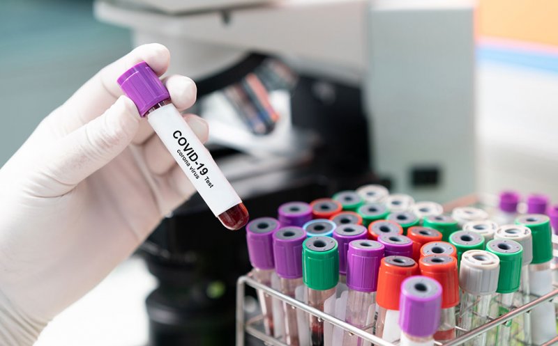 Ministrul Sănătăţii: Statul nu ar trebui să acopere costurile testelor COVID ale celor care refuză vaccinarea, deşi e gratuită