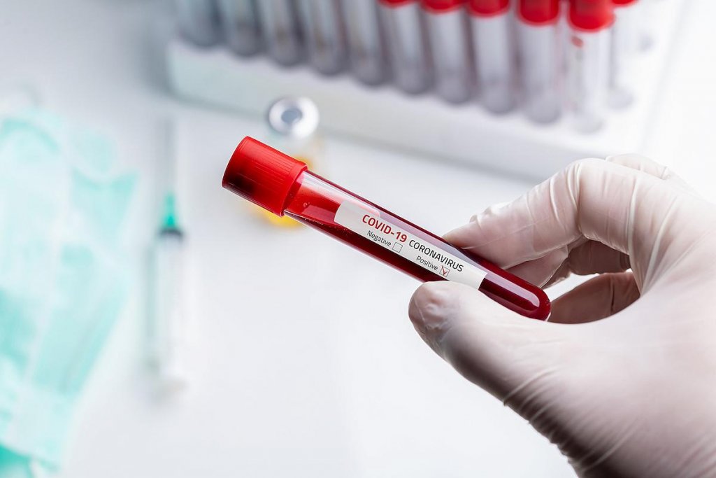 Directorul CNBSCT: 98,7% din persoanele vaccinate au fost protejate până în prezent şi nu s-au infectat