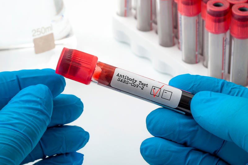 COVID, anticorpii și vaccinul. Ce spune un medic din Israel