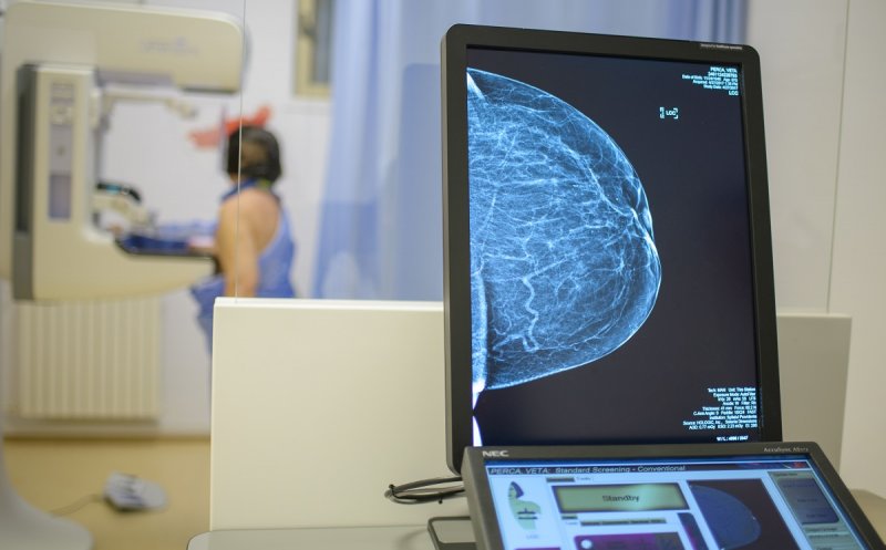 UBB lansează Oncovox, prima platformă gratuită de psihoterapie pentru femeile cu cancer la sân